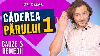 Dr Cezar: Caderea parului, cauze si remedii naturale - Partea 1