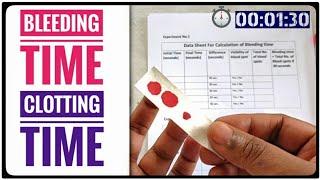 BT CT Test | Bleeding Time AND Clotting Time (Coagulation Time) Blood Test