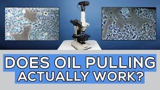 Oil Pulling for 35 Days: Did It Cure Gum Disease? Microscope Analysis