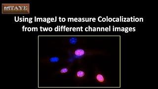 Using ImageJ to measure Colocalization from two different channel images