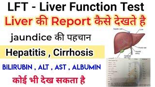 LFT - Liver function test - report कैसे देखे || AST , ALT , Bilirubin , ALP