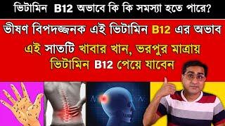 এই 7 টি খাবার ভিটামিন b12 এর ঘাটতি পূরণ করবে | Vitamin b12 Rich Food