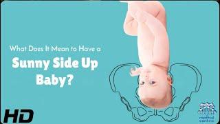 Sunny Side Up Baby: Signs, Risks & Delivery Tips!