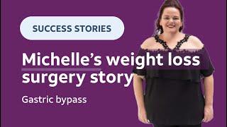 Gastric bypass surgery  Michelle's weight loss surgery story 🩺