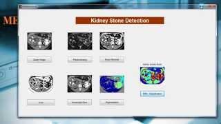 Medical Image Processing Projects | Medical Projects