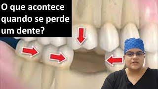 O que acontece quando se perde um dente| Dra Bianca Rosa | Clínica Bianca Rosa