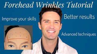 Forehead Wrinkles: Treatment Tutorial (beginner and advanced!)