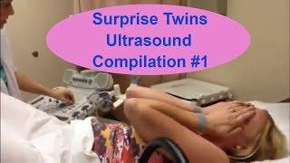 Surprise Twins Ultrasound Compilation #1