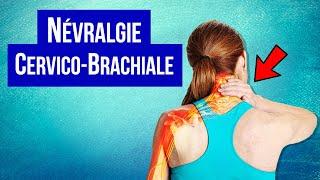 Névralgie cervico-brachiale : Symptôme et Traitement