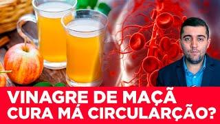 Vinagre de Maçã: remédio natural contra má circulação, coágulos sanguíneos e trombose nas veias?