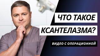 ЧТО ТАКОЕ КСАНТЕЛАЗМА? | БЛЯШКИ НА ВЕКАХ | УДАЛЕНИЕ КСАНТЕЛАЗМЫ КИЕВ | ПЛАСТИКА ВЕК КИЕВ