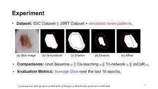 Superpixel-guided Iterative Learning from Noisy Labels for Medical Image Segmentation