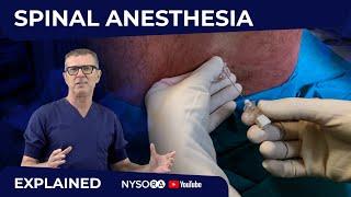 Spinal Anesthesia Explained Part 1- Crash course with Dr. Hadzic