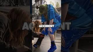 Billie Eilish's Carrer Ending Injury #billieeilish #celebrity