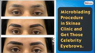 Microblading Procedure in Skinaa Clinic