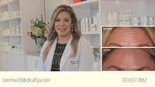 BOTOX at Greenwich Medical Spa