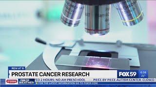 IU research discovery could mean new treatment for prostate cancer