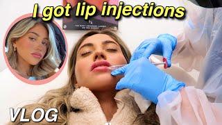 I GOT LIP INJECTIONS VLOG!! *full experience, before & after* ft. LaserAway