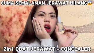 REVIEW OBAT + CONCEALER JERAWAT‼️