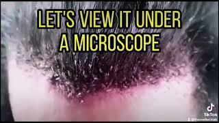 Lice under the microscope #kuto #liceinfestation