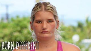 The Girl Who Can’t Smile | BORN DIFFERENT