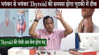 भयंकर से भयंकर Thyroid की समस्या होगा चुटकी में ठीक /Thyroid की गोली अब लेना होगा बंद