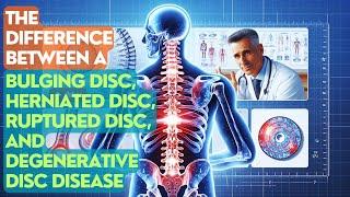 The Difference Between A Bulging Disc, Herniated Disc, Ruptured Disc, And Degenerative Disc Disease