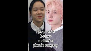 kpop idols before and after plastic surgery [ part 1 ]#shorts #enhypen #itzy #ive #aespa #kpopedit