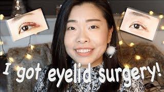 MEDICALLY REQUIRED DOUBLE EYELID SURGERY?! | Watch My Recovery