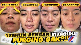 1 TAHUN DENGAN TRETINOIN