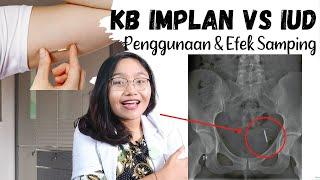 IUD (AYUDI) VS KB IMPLAN  | KEPUTIHAN? TEMBUS KE PERUT? HAMIL LAGI ? Penggunaan & Efek Samping