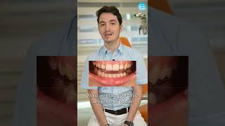 Is your smile aesthetic? Lets check it together? Can Çolpan explains ️ #veneer