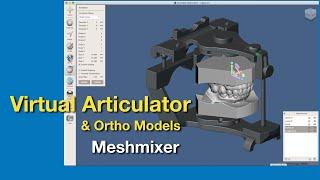 Virtual Articulator and ortho casts