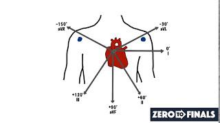 Understanding ECG Axis and Axis Deviation