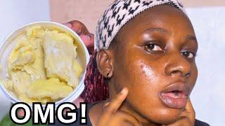 I Used Shea Butter On My Face Everyday For One Week...