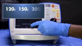 R Series Defibrillation (Software prior to v 14)