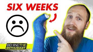 Life With A Broken Hand (6 Weeks Update) | Behind The Enthusiast