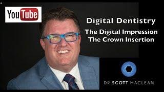 Dentistry - Digital Scan Impression - Intra Oral Scanning