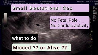 Ultrasound Early Pregnancy with Small Empty Gestational Sac   , explained   , what to do ??