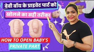 How To Open Baby Boy Private Part| बेबी बॉय का सुसु कैसे खोले |बेबी बॉय का प्राइवेट पार्ट कैसे खोलें