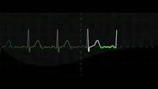 9 hours of Heart rate monitoring EKG grapihics with beeping