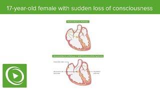 USMLE Step 1: Anatomy Question #4: Walkthrough Tutorial by DocOssareh | Lecturio