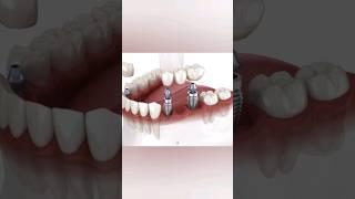 #dental #teeth #animation #viral #shorts #health #motivation #3d #fitness #gym #3danimation #anatomy