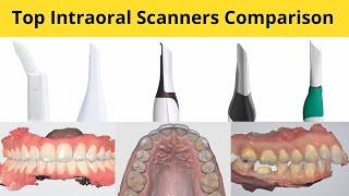 Top Intraoral Scanners Comparison