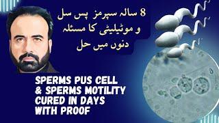 Pus cell in Semen &  Sperm Motility  Cured With   Al saif homeo regime  in Days |Urdu , Hindi |