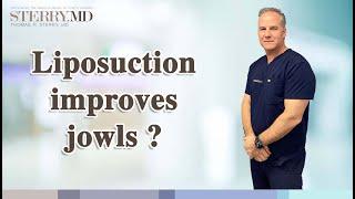 Can You Improve Your Jowls With Chin & Neck Liposuction? I Dr. Thomas P. Sterry in NYC