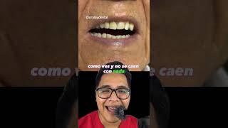 Prótesis dental económicas #dientes #dentista #tips #parati #viral #fyp #shorts #shortvideo #fypシ