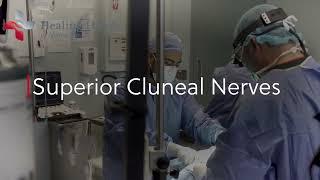 Failed Back Syndrome and Superior Cluneal Nerves