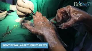 Microscopic Testicular Sperm Extraction by Dr. Manu Gupta