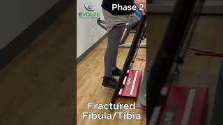 Fractured Fibula and Tibia: Building Back Calf Strength With Blood Flow Restriction Bands | Phase 2